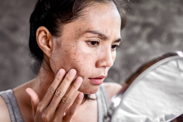 Woman examining her face in a mirror for skin issues